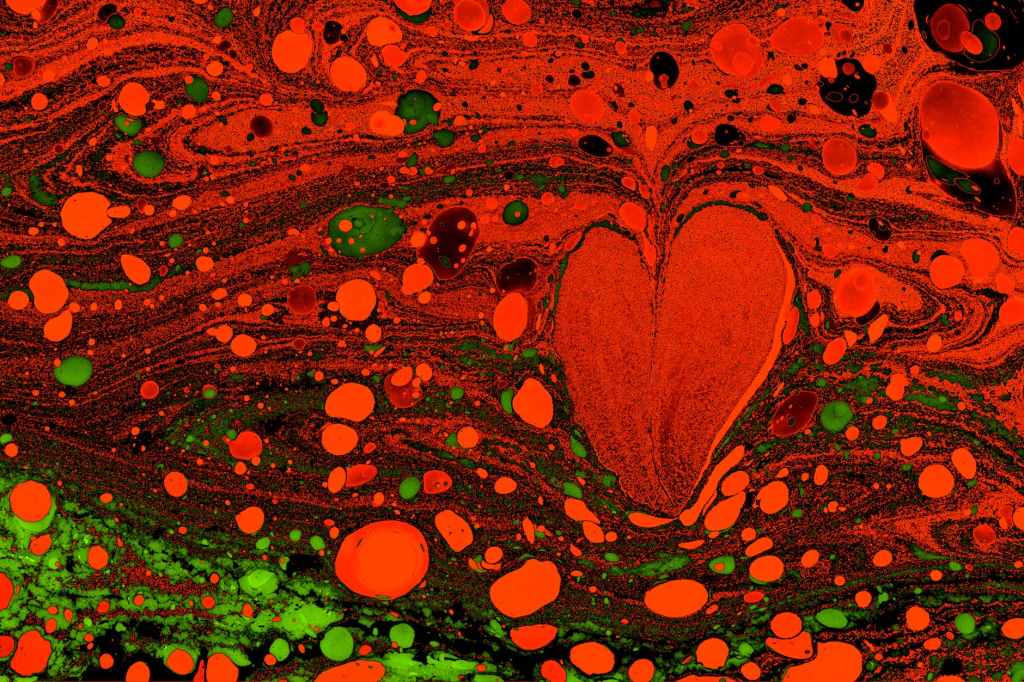 Is Heartbreak Anti-Feminist?